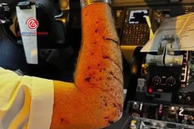 Gizemli çarpışma: Uzay çöpü ihtimali havacılık dünyasında tartışılıyor