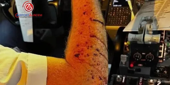 Gizemli çarpışma: Uzay çöpü ihtimali havacılık dünyasında tartışılıyor